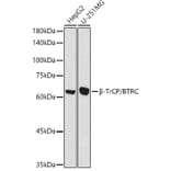 Western Blot - Anti-Beta TRCP / HOS Antibody (A307151) - Antibodies.com
