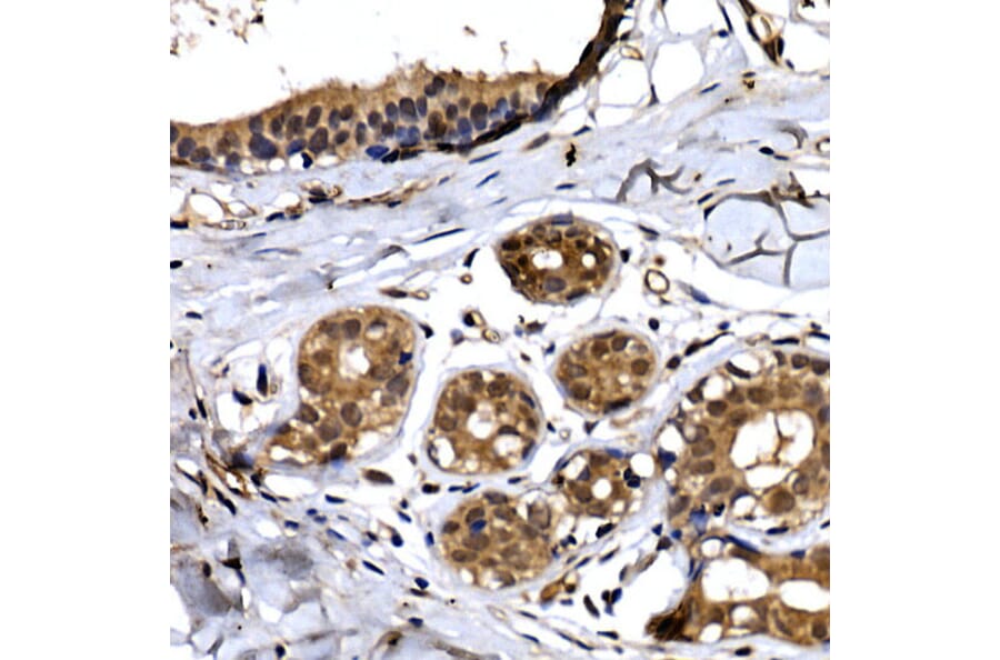 Immunohistochemistry - Anti-Beta TRCP / HOS Antibody (A307151) - Antibodies.com