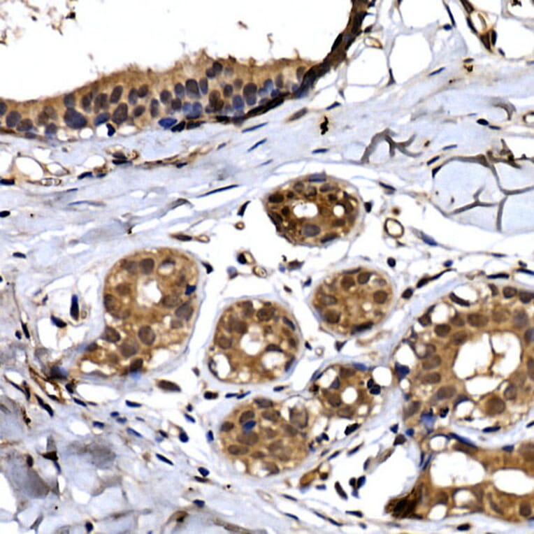 Immunohistochemistry - Anti-Beta TRCP / HOS Antibody (A307151) - Antibodies.com