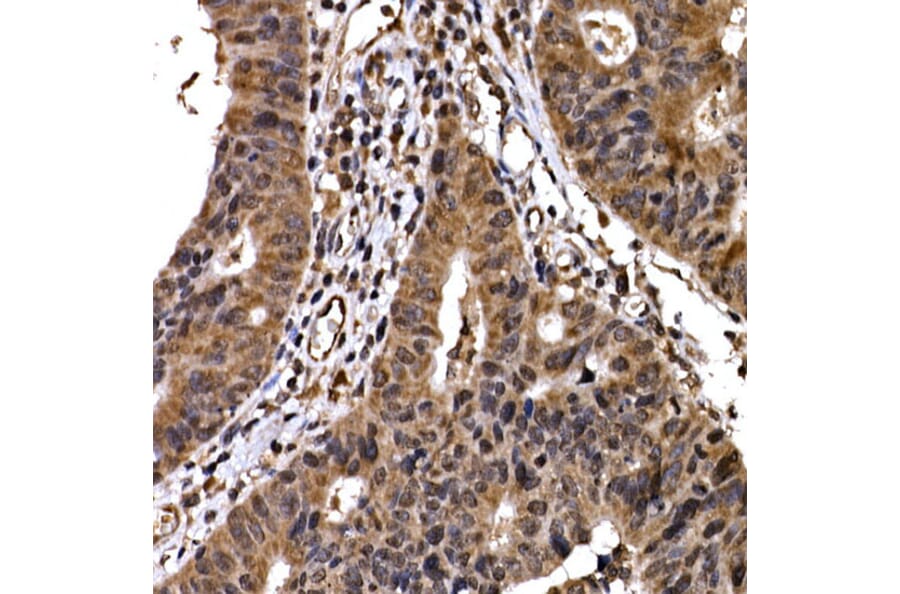Immunohistochemistry - Anti-Beta TRCP / HOS Antibody (A307151) - Antibodies.com