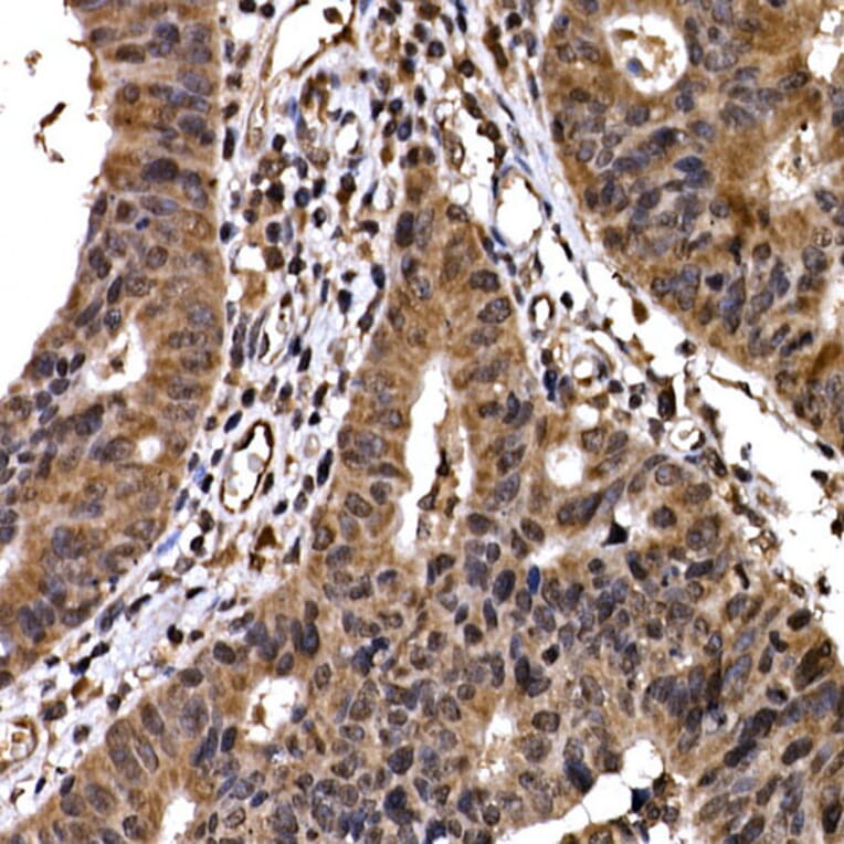Immunohistochemistry - Anti-Beta TRCP / HOS Antibody (A307151) - Antibodies.com