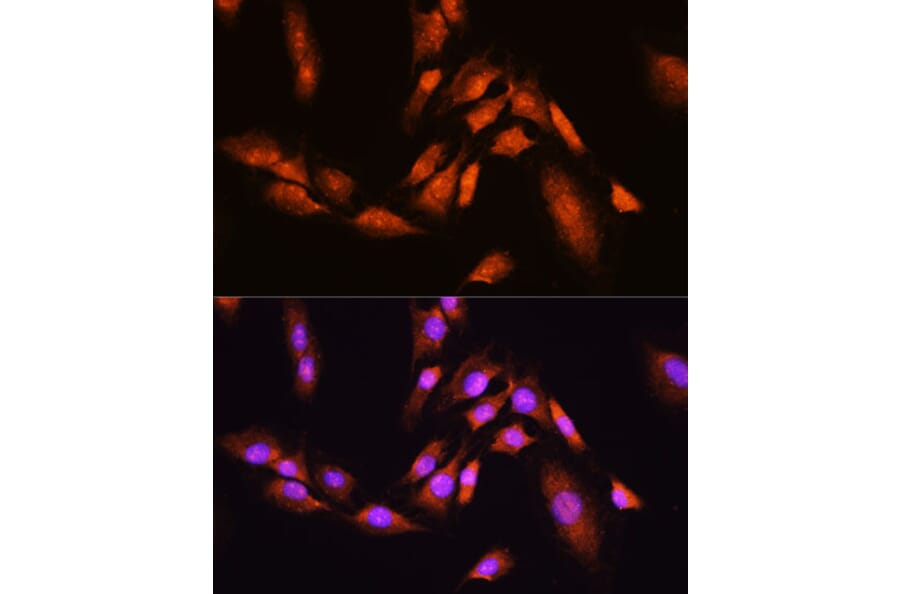 Immunofluorescence - Anti-Beta TRCP / HOS Antibody (A307151) - Antibodies.com