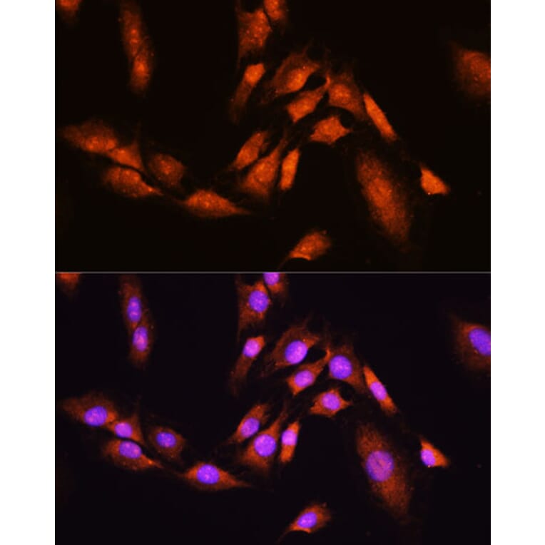Immunofluorescence - Anti-Beta TRCP / HOS Antibody (A307151) - Antibodies.com