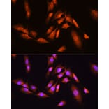 Immunofluorescence - Anti-Beta TRCP / HOS Antibody (A307151) - Antibodies.com