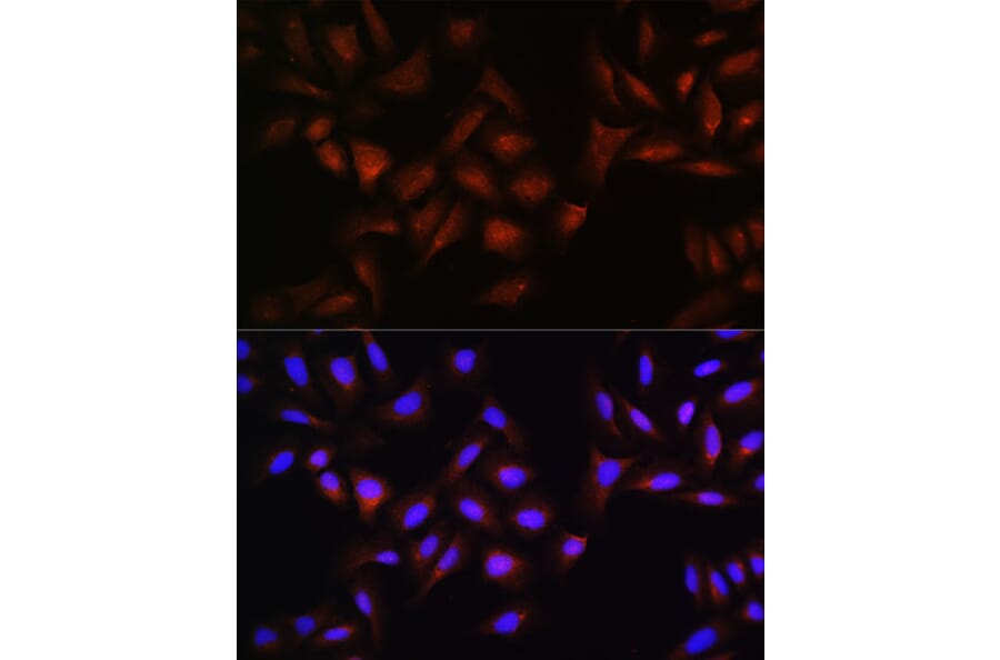 Immunofluorescence - Anti-Beta TRCP / HOS Antibody (A307151) - Antibodies.com