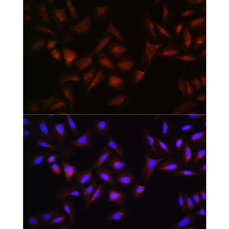 Immunofluorescence - Anti-Beta TRCP / HOS Antibody (A307151) - Antibodies.com