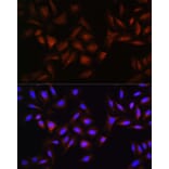Immunofluorescence - Anti-Beta TRCP / HOS Antibody (A307151) - Antibodies.com