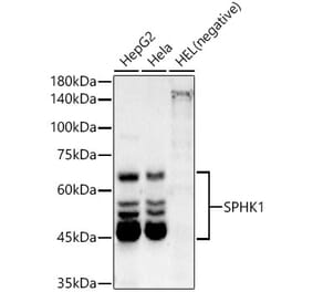 Western Blot - Anti-SPHK1 Antibody [ARC54487] (A307152) - Antibodies.com