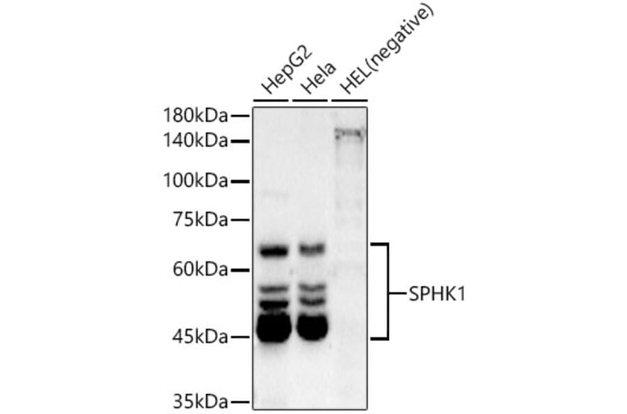 Western Blot - Anti-SPHK1 Antibody [ARC54487] (A307152) - Antibodies.com