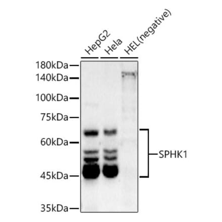 Western Blot - Anti-SPHK1 Antibody [ARC54487] (A307152) - Antibodies.com