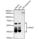 Western Blot - Anti-SPHK1 Antibody [ARC54487] (A307152) - Antibodies.com