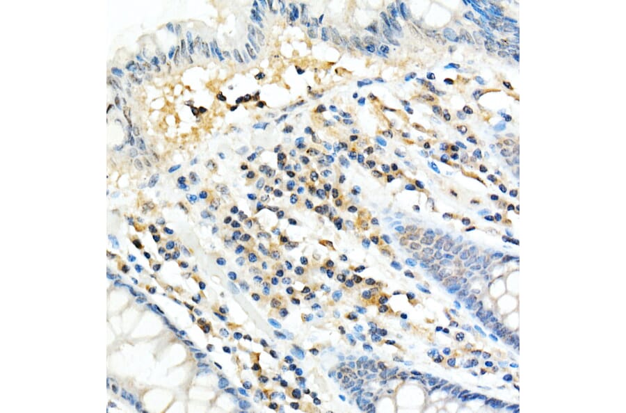 Immunohistochemistry - Anti-FADD Antibody [ARC51937] (A307153) - Antibodies.com