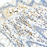 Immunohistochemistry - Anti-FADD Antibody [ARC51937] (A307153) - Antibodies.com