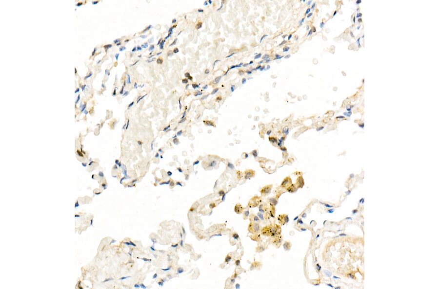 Immunohistochemistry - Anti-FADD Antibody [ARC51937] (A307153) - Antibodies.com