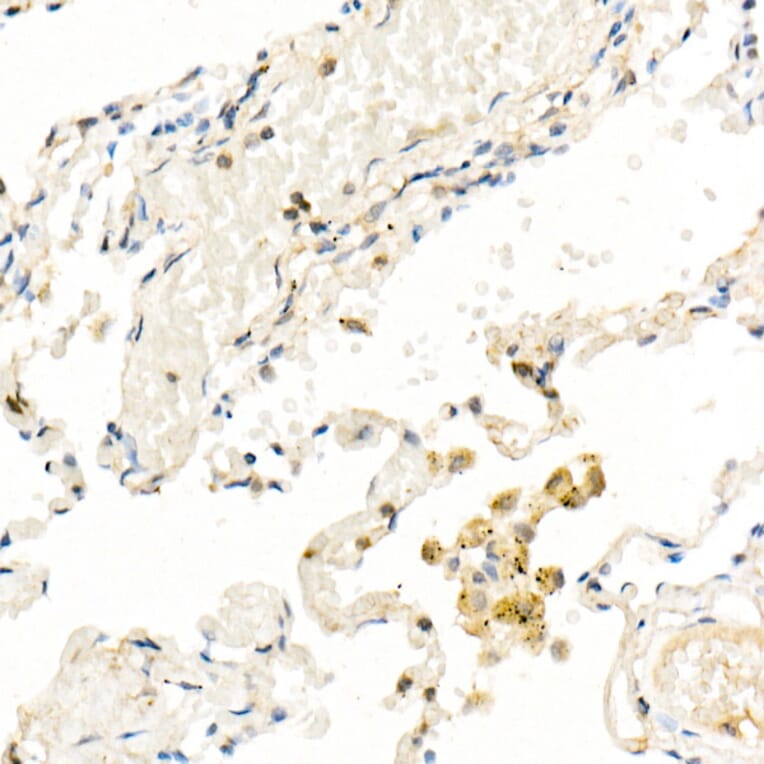 Immunohistochemistry - Anti-FADD Antibody [ARC51937] (A307153) - Antibodies.com