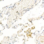 Immunohistochemistry - Anti-FADD Antibody [ARC51937] (A307153) - Antibodies.com