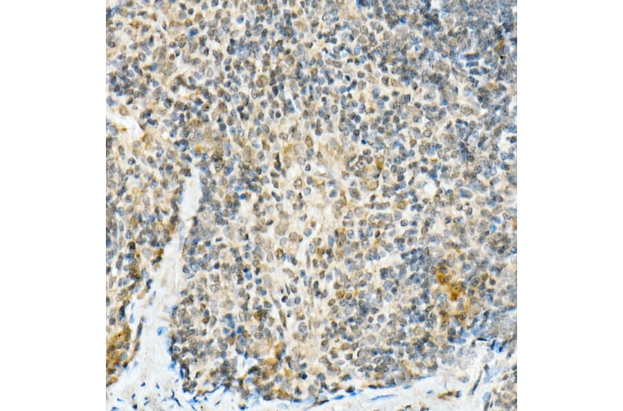 Immunohistochemistry - Anti-FADD Antibody [ARC51937] (A307153) - Antibodies.com