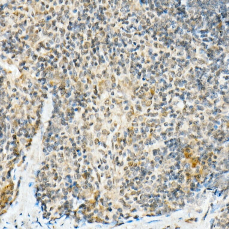 Immunohistochemistry - Anti-FADD Antibody [ARC51937] (A307153) - Antibodies.com