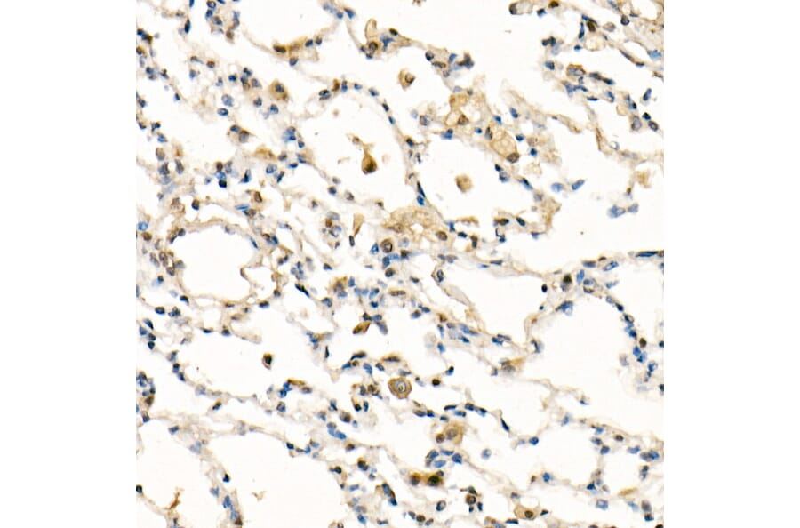 Immunohistochemistry - Anti-FADD Antibody [ARC51937] (A307153) - Antibodies.com