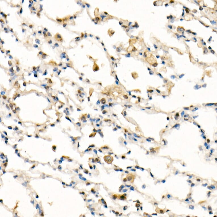 Immunohistochemistry - Anti-FADD Antibody [ARC51937] (A307153) - Antibodies.com