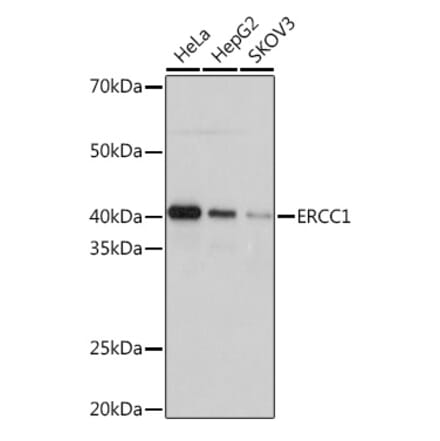 Western Blot - Anti-ERCC1 Antibody [ARC1241] (A307156) - Antibodies.com