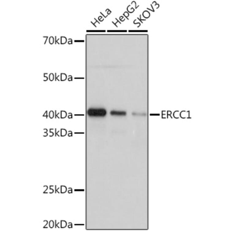 Western Blot - Anti-ERCC1 Antibody [ARC1241] (A307156) - Antibodies.com