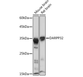 Western Blot - Anti-DARPP32 Antibody [ARC2095] (A307157) - Antibodies.com