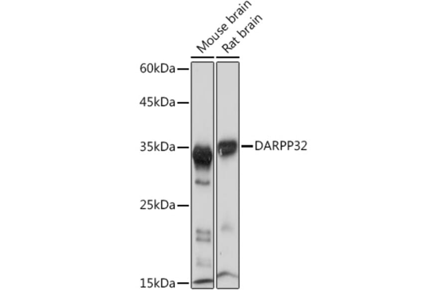 Western Blot - Anti-DARPP32 Antibody [ARC2095] (A307157) - Antibodies.com