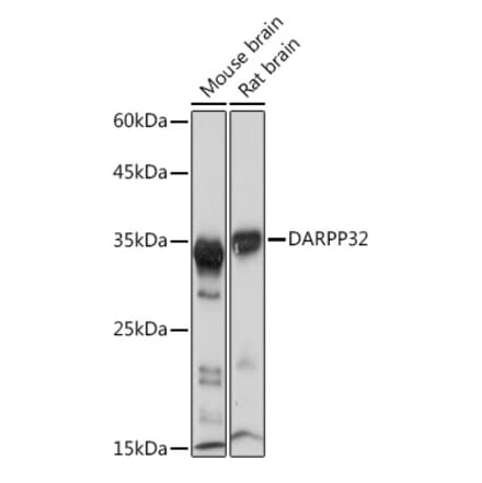Western Blot - Anti-DARPP32 Antibody [ARC2095] (A307157) - Antibodies.com