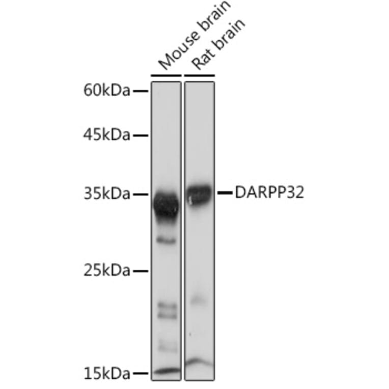 Western Blot - Anti-DARPP32 Antibody [ARC2095] (A307157) - Antibodies.com