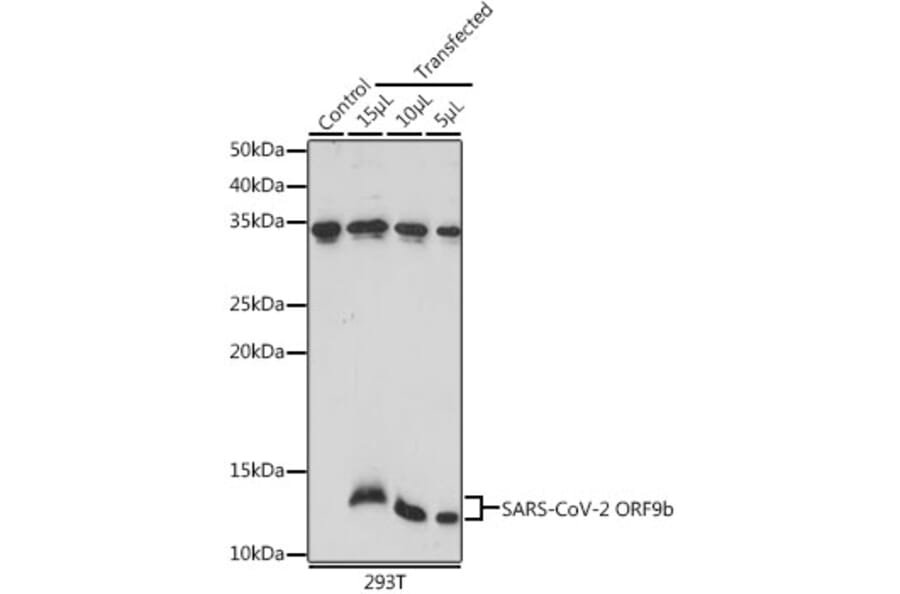 Western Blot - Anti-SARS-CoV2 ORF9b Antibody (A307158) - Antibodies.com