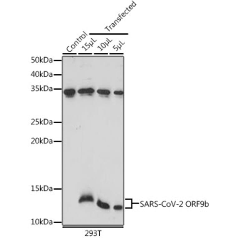 Western Blot - Anti-SARS-CoV2 ORF9b Antibody (A307158) - Antibodies.com