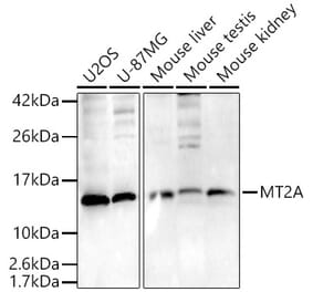 Western Blot - Anti-Metallothionein Antibody (A307159) - Antibodies.com