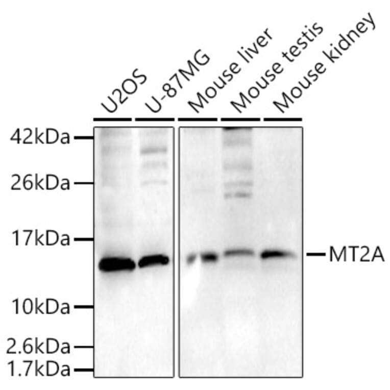 Western Blot - Anti-Metallothionein Antibody (A307159) - Antibodies.com