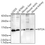 Western Blot - Anti-Metallothionein Antibody (A307159) - Antibodies.com