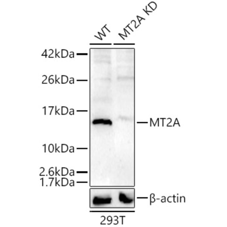 Western Blot - Anti-Metallothionein Antibody (A307159) - Antibodies.com