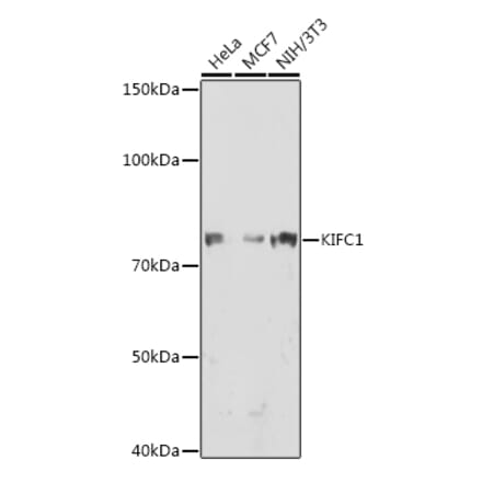 Western Blot - Anti-KIFC1 Antibody [ARC1808] (A307161) - Antibodies.com