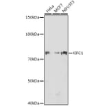 Western Blot - Anti-KIFC1 Antibody [ARC1808] (A307161) - Antibodies.com