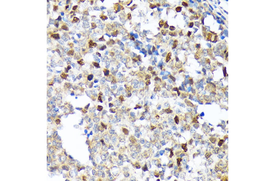 Immunohistochemistry - Anti-KIFC1 Antibody [ARC1808] (A307161) - Antibodies.com