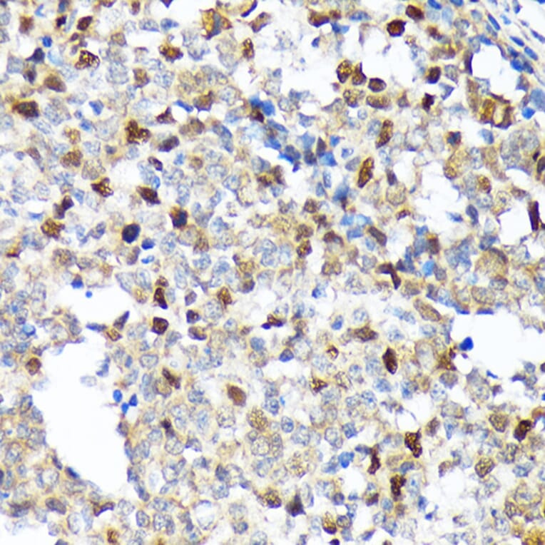 Immunohistochemistry - Anti-KIFC1 Antibody [ARC1808] (A307161) - Antibodies.com