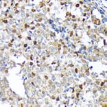 Immunohistochemistry - Anti-KIFC1 Antibody [ARC1808] (A307161) - Antibodies.com