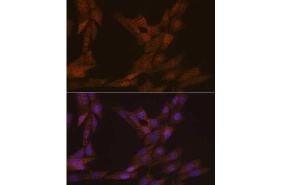 Immunofluorescence - Anti-KIFC1 Antibody [ARC1808] (A307161) - Antibodies.com