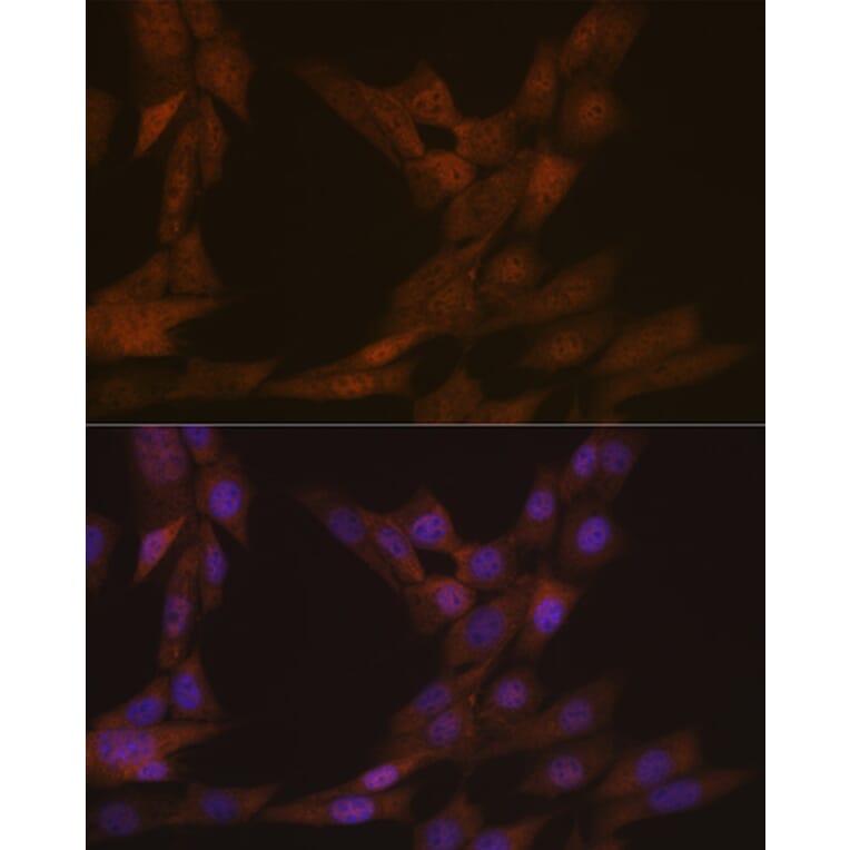 Immunofluorescence - Anti-KIFC1 Antibody [ARC1808] (A307161) - Antibodies.com