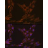 Immunofluorescence - Anti-KIFC1 Antibody [ARC1808] (A307161) - Antibodies.com