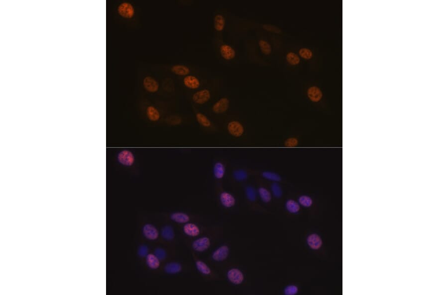 Immunofluorescence - Anti-KIFC1 Antibody [ARC1808] (A307161) - Antibodies.com