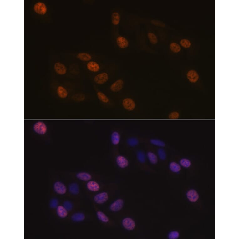 Immunofluorescence - Anti-KIFC1 Antibody [ARC1808] (A307161) - Antibodies.com