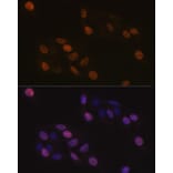 Immunofluorescence - Anti-KIFC1 Antibody [ARC1808] (A307161) - Antibodies.com