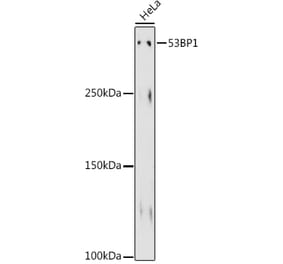 Western Blot - Anti-53BP1 Antibody [ARC0850] (A307163) - Antibodies.com