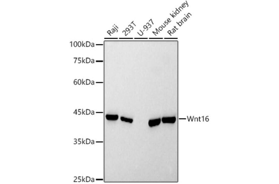 Western Blot - Anti-Wnt16 Antibody [ARC2862] (A307164) - Antibodies.com