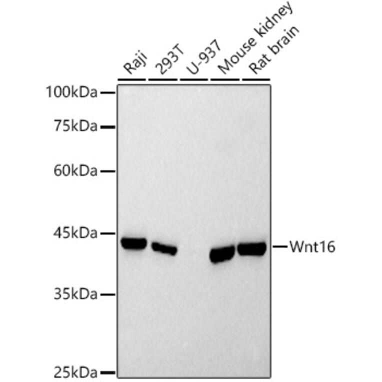 Western Blot - Anti-Wnt16 Antibody [ARC2862] (A307164) - Antibodies.com